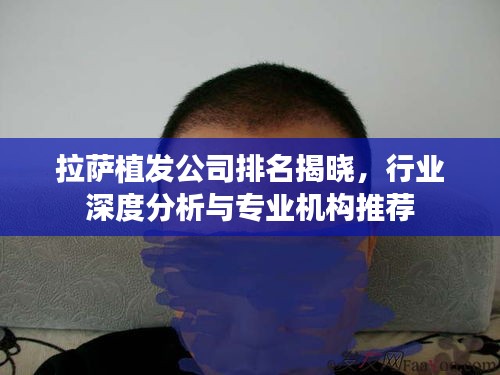 拉萨植发公司排名揭晓，行业深度分析与专业机构推荐
